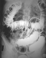 Fluoroscopy