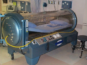 hyperbaric chamber