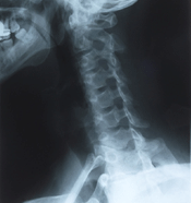 X-rays